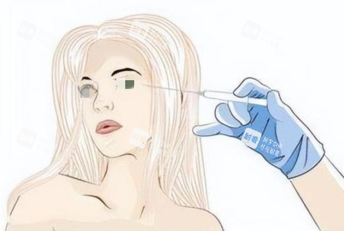 注射胶原蛋白去泪沟示意图 注射胶原蛋白去泪沟示意图