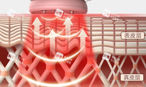 光子嫩肤激光作用展示 光子嫩肤激光作用展示