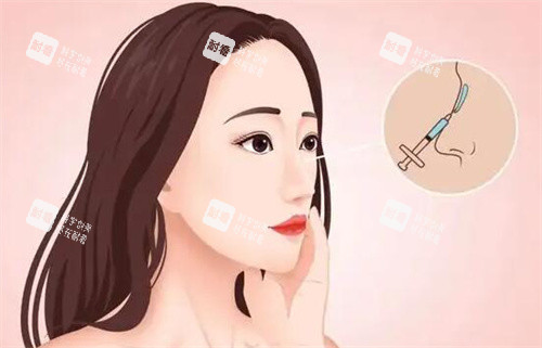 注射隆鼻卡通图 注射隆鼻卡通图