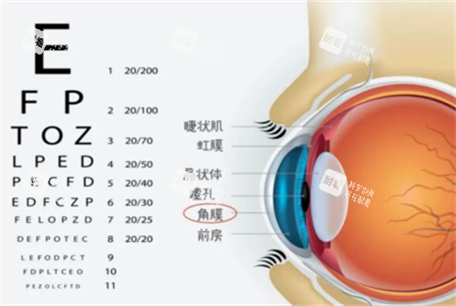 角膜位置图解 角膜位置图解
