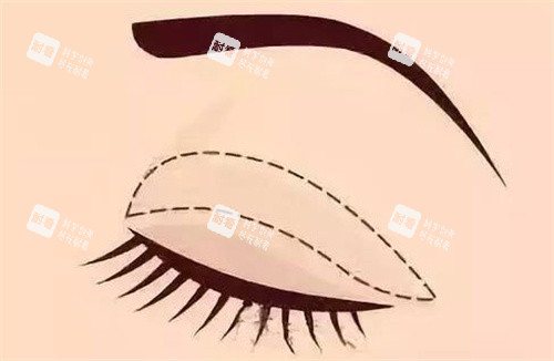 韩国Shine整形医院怎么样？眼鼻整形价格/医生资质/术后结果多方面解析，看完再决定！