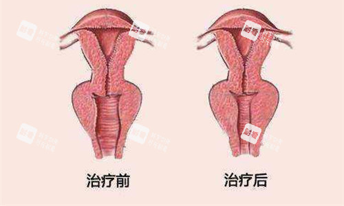 私密治疗对比图