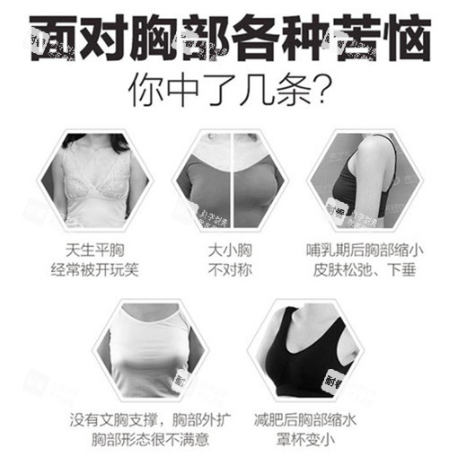 胸部整形适应症