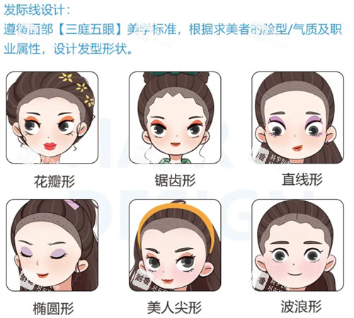 济南熙朵植发发际线种植优势介绍 济南熙朵植发发际线种植优势介绍