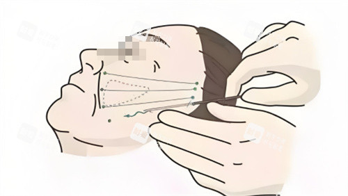 郑州郭玉瑞在哪家医院？坐诊河南中医药大学三附院，正规医美科室可预约