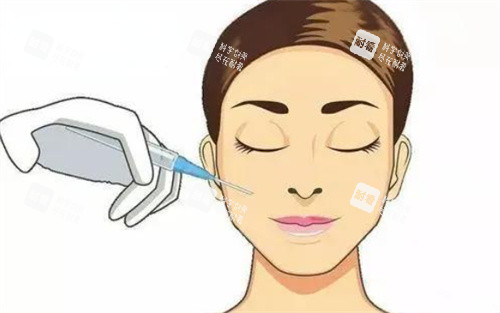 面部注射示图 面部注射示图