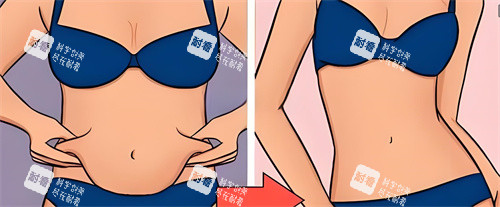腹部吸脂术前后对比动画图 腹部吸脂术前后对比动画图