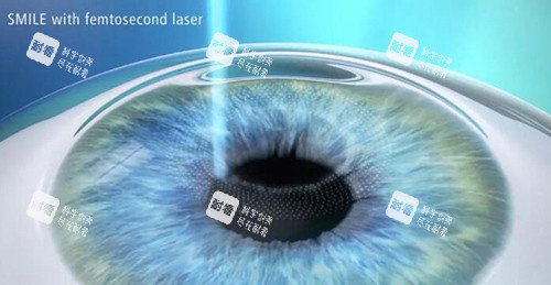 中山大学中山眼科中心怎么挂号？2026比较全官网/微信号预约流程及医师号抢号攻略