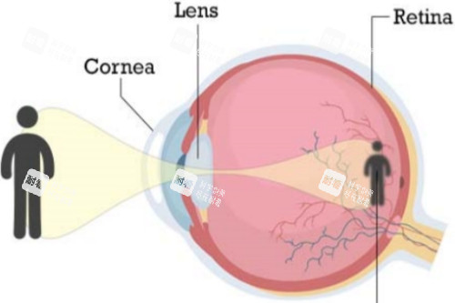近视视物示意图