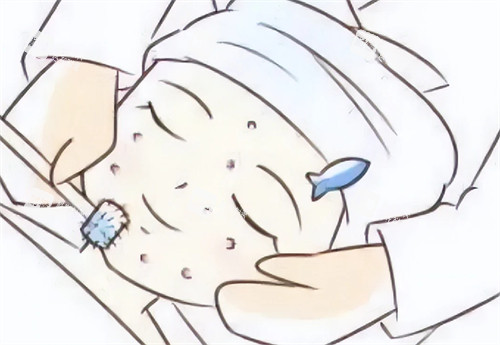 微针施术过程图片