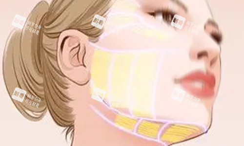 拉皮手术范围示意图 拉皮手术范围示意图