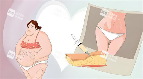 抽脂手术前后对比动画图 抽脂手术前后对比动画图