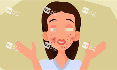 面部伤疤密布卡通图 面部伤疤密布卡通图