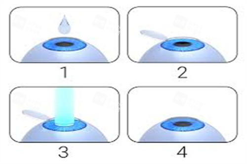 柳州赋盈眼科正规吗？超合规！消毒流程严格规范，医疗安心有维持，医师团队特色，看眼无忧 
