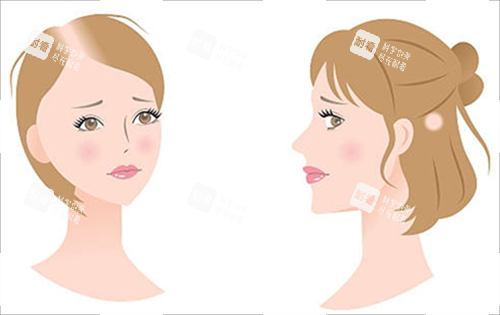 各种脱发素材 各种脱发素材