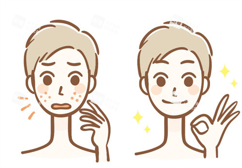 祛斑前后卡通对比图 祛斑前后卡通对比图