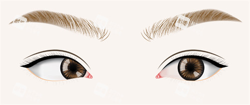 斜视眼睛和正常眼睛