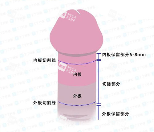 男性阴茎照片 男性阴茎照片