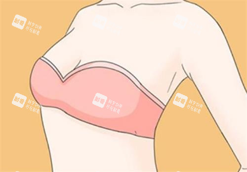 隆胸术后成效图