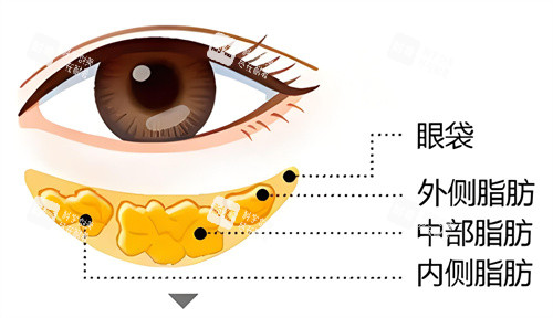 眼袋问题形成因