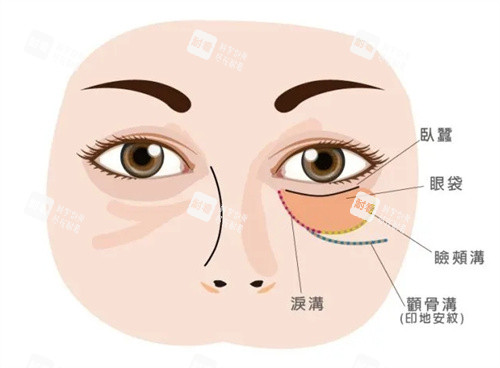 眼袋位置卡通图片