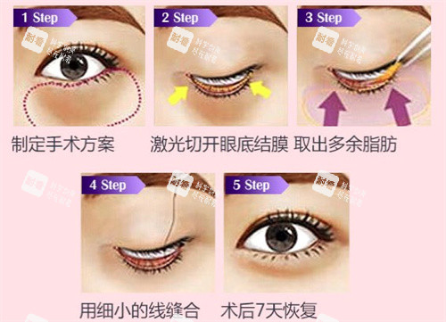 金华玥莱美医疗美容整形价格表:双眼皮2800元起、隆鼻3800元起、隆胸19800元起