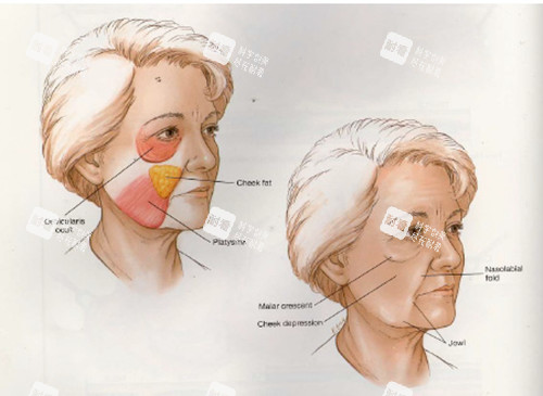面部线提升对比 面部线提升对比