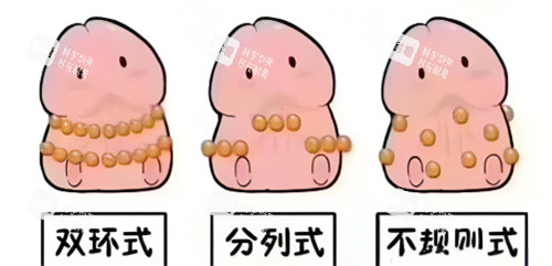 入珠手术动画3 入珠手术动画3