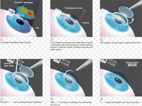 全飞秒过程演示