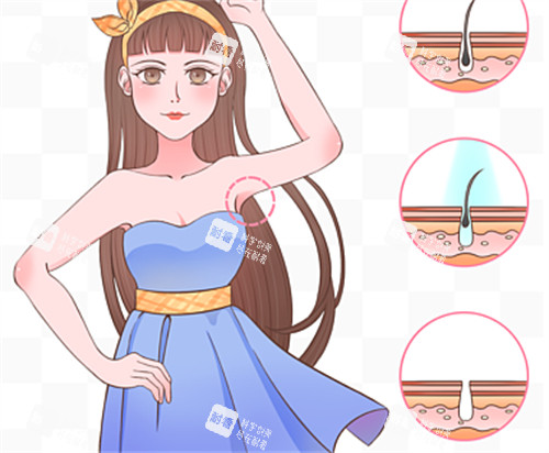 腋下脱毛前后毛囊对比图 腋下脱毛前后毛囊对比图