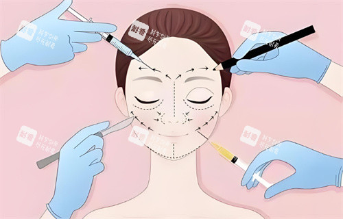 面部注射图展示