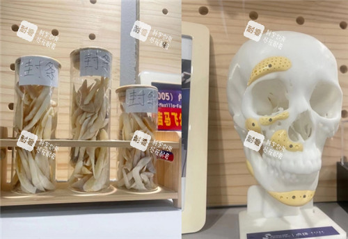 重庆松山医院截骨整理图 重庆松山医院截骨整理图