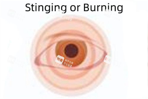 刺痛或灼伤 刺痛或灼伤