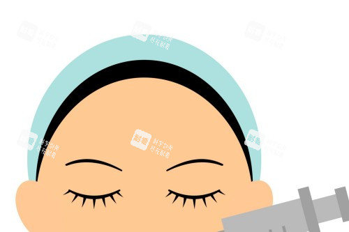 面部注射示意图 面部注射示意图