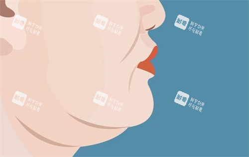 双下巴的样子卡通图