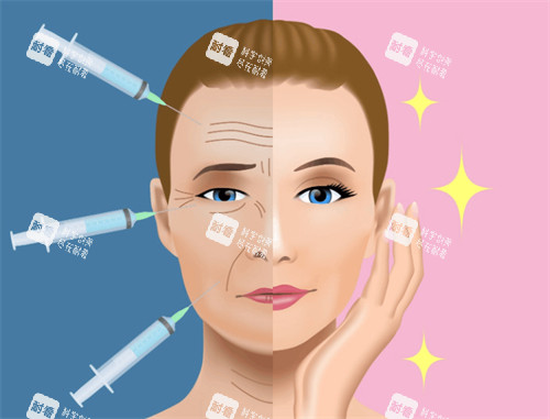 昆明注射医生钱静怎么样？深耕注射抗衰领域，擅长法令纹修复/泪沟填充/面部提升，适配全龄段