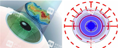 芒市艾维眼科医院地址在哪里?金孔雀大街85号，一文读懂就诊全流程攻略