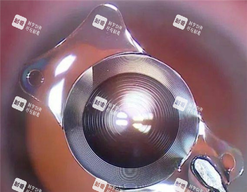 人工晶体悬吊术费用是多少？8k~3w元不等，治疗晶状体脱位和白内障手术等成效好维持时间久