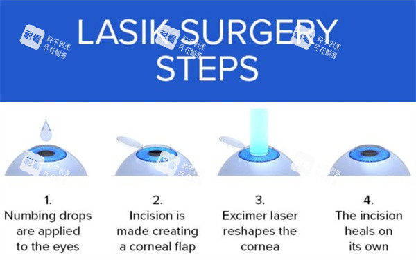北京朝聚眼科口碑好不好？超扎实！京城正规眼科机构，屈光矫正技术硬，术后干眼发生率低，患者反馈体验超