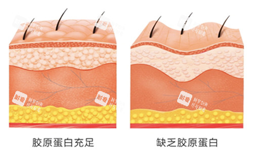 胶原蛋白 胶原蛋白