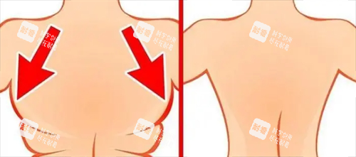 背部吸脂前后动画对比图