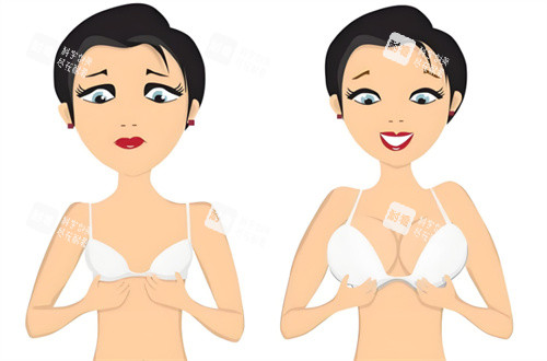 穆大力医生隆胸技术在线解读：内窥镜双平面隆胸如何兼顾形态美与可靠性