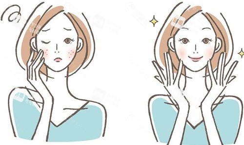 激光祛斑后的成效 激光祛斑后的成效