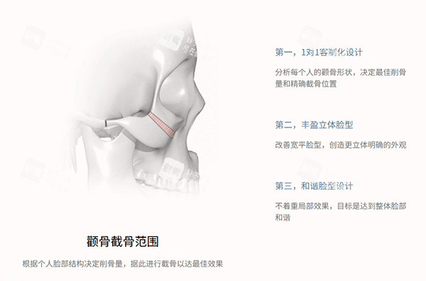 韩国345整形面部轮廓手术 韩国345整形面部轮廓手术