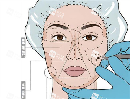 面部轮廓整形卡通设计图片 面部轮廓整形卡通设计图片