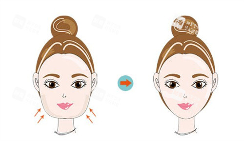 面部轮廓 面部轮廓