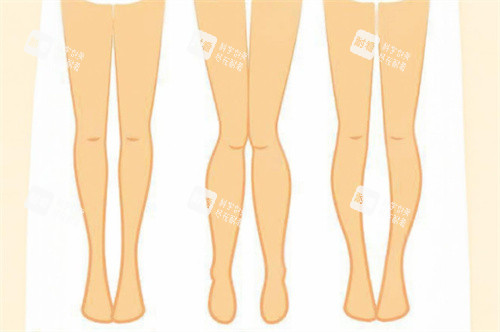 腿型对比