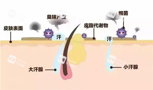 狐臭怎么产生的