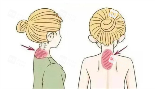 脖子富贵包卡通图展示