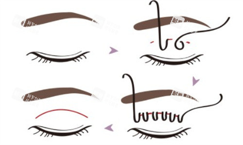 网选银川整形医院排行榜!丽都/时光相伴/华美等5家口碑机构,技术价格双在线超靠谱